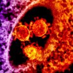 First Human Death Linked to Livestock-Borne Shamonda Virus Reported in France