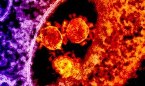 First Human Death Linked to Livestock-Borne Shamonda Virus Reported in France