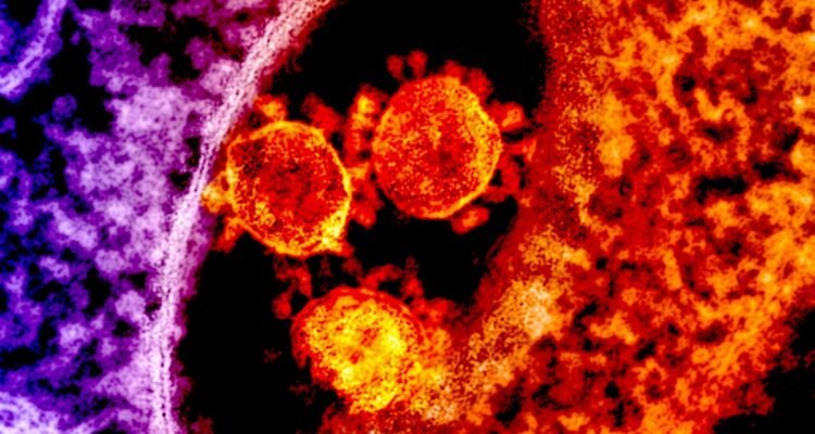 First Human Death Linked to Livestock-Borne Shamonda Virus Reported in France